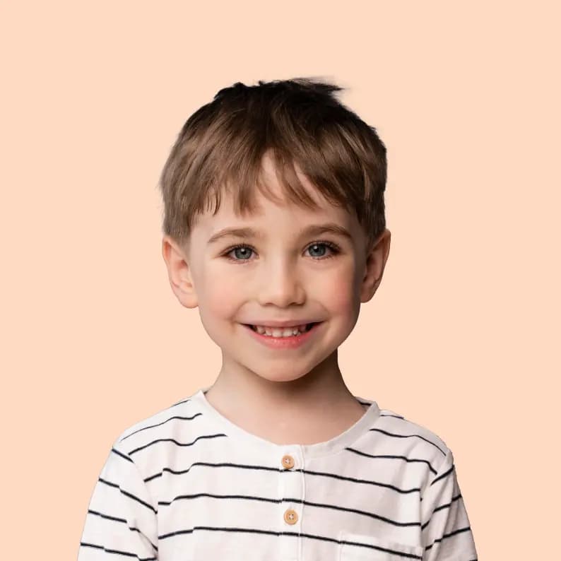 Çocuk Tipi Saç Dökülmesi