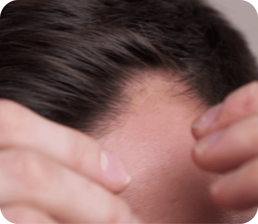 Biyoteknolojik Serum ve Losyon Uygulamaları