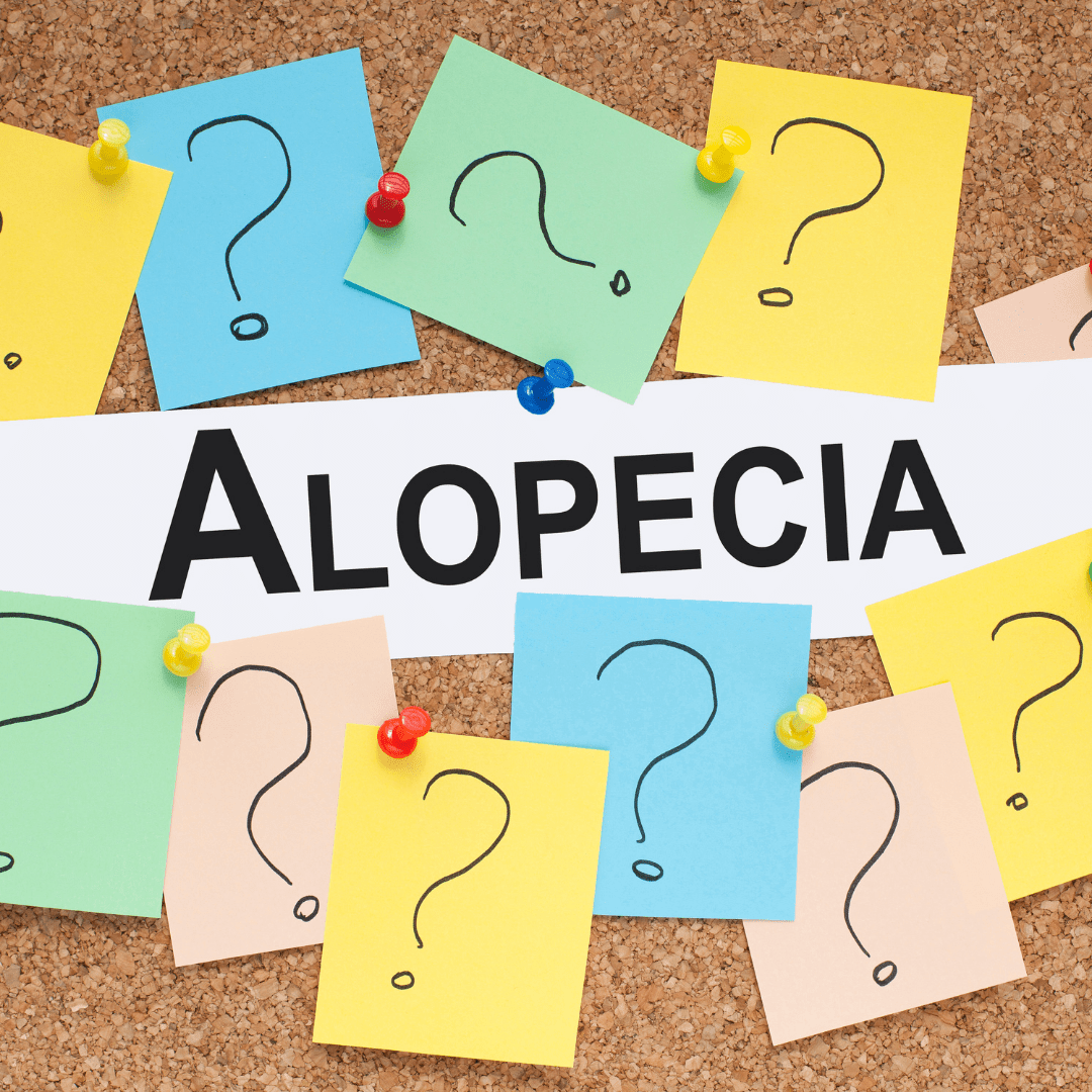 Saç Kıran Nedir? Alopecia Areata